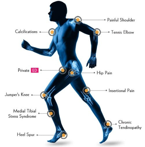 Small Biz Saturday 10 sessions Shockwave ESWT Promo