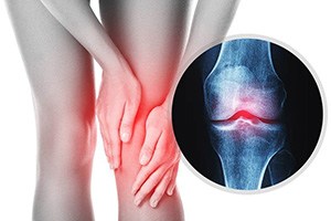 Spring Promo PSC  12 Sessions Knee on Trac, Get one Free